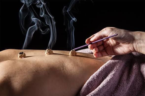 Moxibustion et thermothérapie