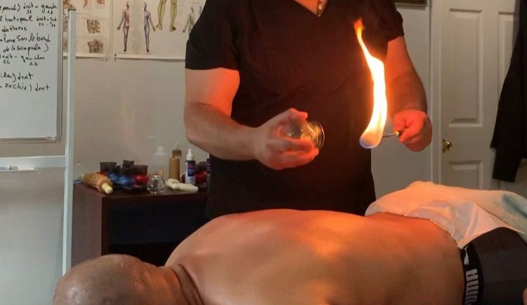 Massage thérapeutique avec ventouses chaudes