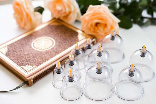Cupping thérapie prophetique (hajama)